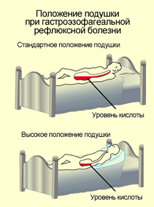 диета номер 7 нефрология