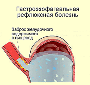 кремлевская диета рецепты d пост или рекомендации по совершенствованию диетического питания в общественном питании