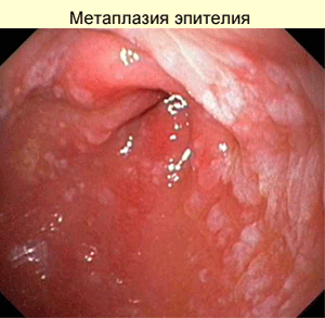 диета с которой можно похудеть на 20 кг