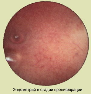 Фото эндометрий во время менструального цикла