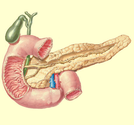 Поджелудочная железа камни бывают