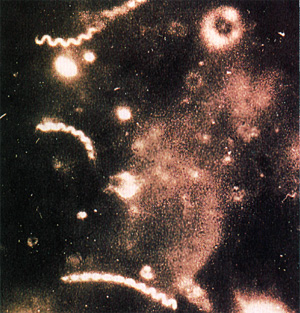 Бледная трепонема вызывает сифилис, фото