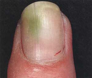 Зеленый цвет ногтя, фото