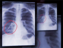 Диагностика нарушений дыхания, фото