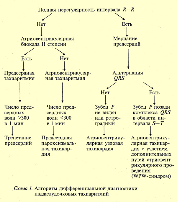 Дифференциальная диагностика наджелудочковых тахиаритмий, фото