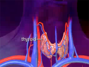 Что такое аденома щитовидной железы, фото