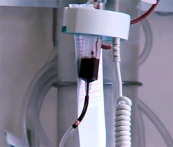 переливание крови при гемолитической анемии
