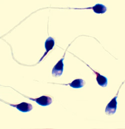 Что такое тест на жизнеспособность сперматозоидов, фото