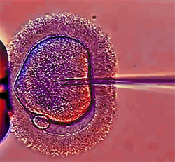 Инъекция сперматозоида в яйцеклетку, фото