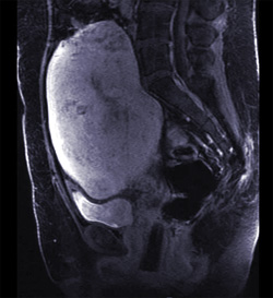 Компьютерная томография брюшной полости и малого таза, фото