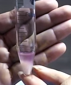 Методы отбора сперматозоидов для ЭКО, фото