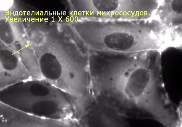 эндотелиальные клетки микрососудов, фото