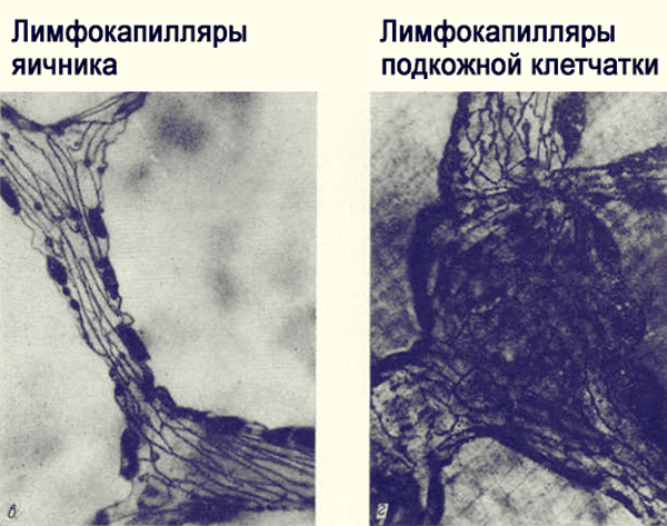лимфатические сети яичника и подкожной клетчатки