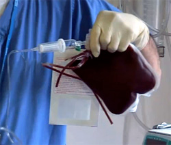 переливание крови при агранулоцитозе, фото