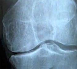 Рентген суставов, фото