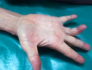 Палец в положении застегивания пуговицы, фото