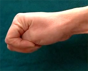 Что такое щелкающий палец, фото