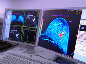 Цифровая маммография, фото