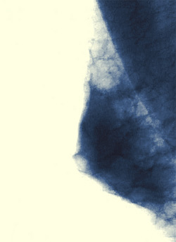 Как выглядит молочная железа на рентгенограмме, фото