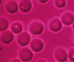 Анализы крови, фото
